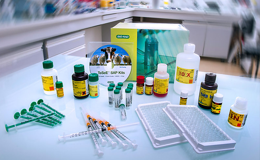 Dépistage de la maladie de Creutzfeldt-Jakob